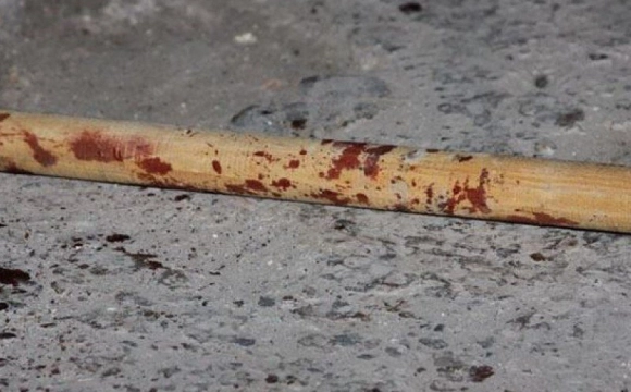 В Охтирці суд оштрафував жінку за побиття співмешканця милицею та палицею
